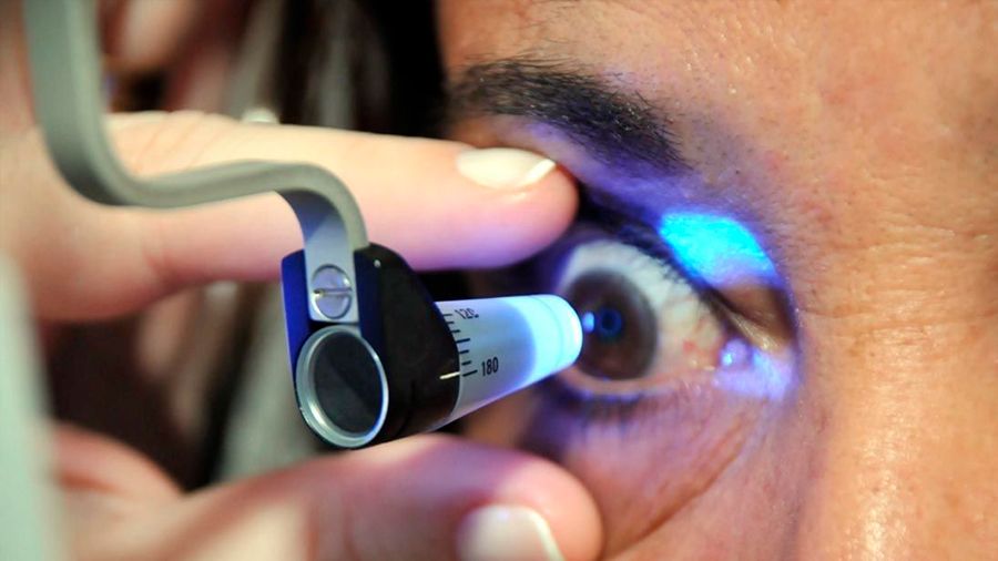 laser-optical-glaucoma